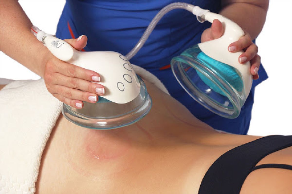 Lifting Colombien à Saint-André-des-Eaux (44) Par Anais - Estheca