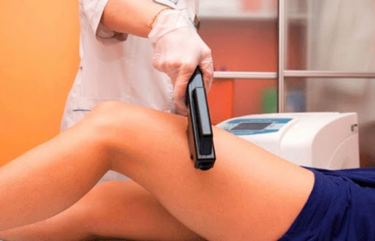 Épilation définitive Lumière pulsée à Saran (45) Par Coralie - Estheca