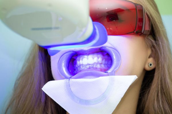 À Rubelles | Blanchiment dentaire | Les meilleures esthéticiennes