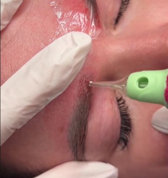 À Pia | Détatouage sourcils et lèvres | Les meilleures esthéticiennes