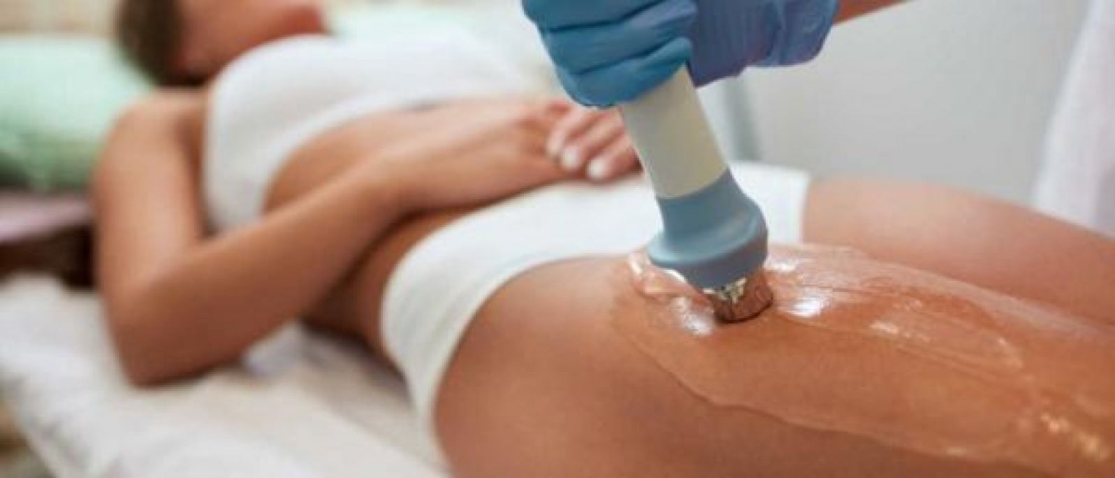 Lipocavitation Radiofréquence à Toulouse (31) Par Surya - Estheca