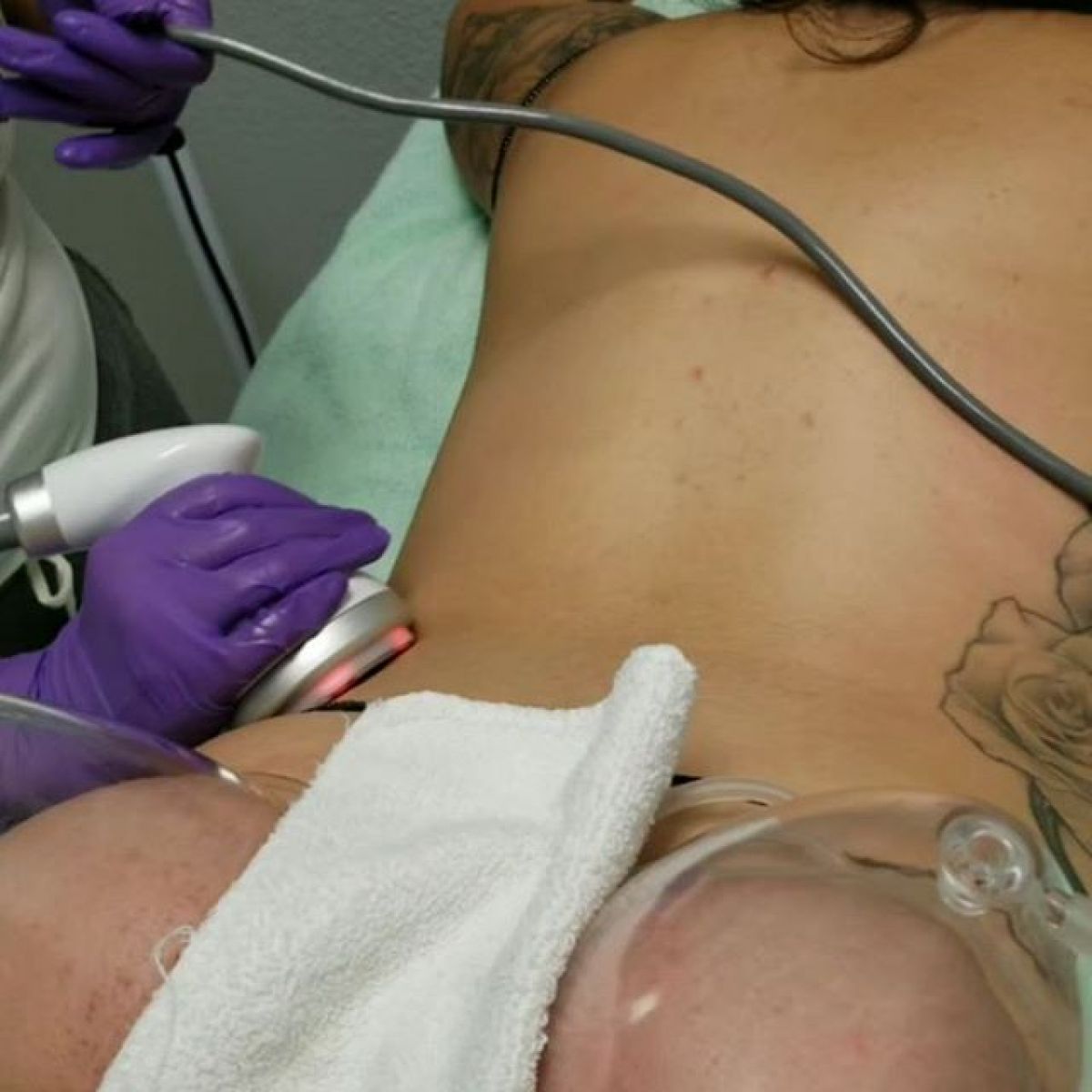 Radio fréquence et Lipocavitation à Villeneuve-Loubet (06) Par Amandine - Estheca
