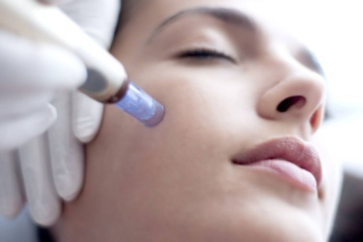 Microneedling/B.B. Glow  à Lille (59) Par Safia - Estheca