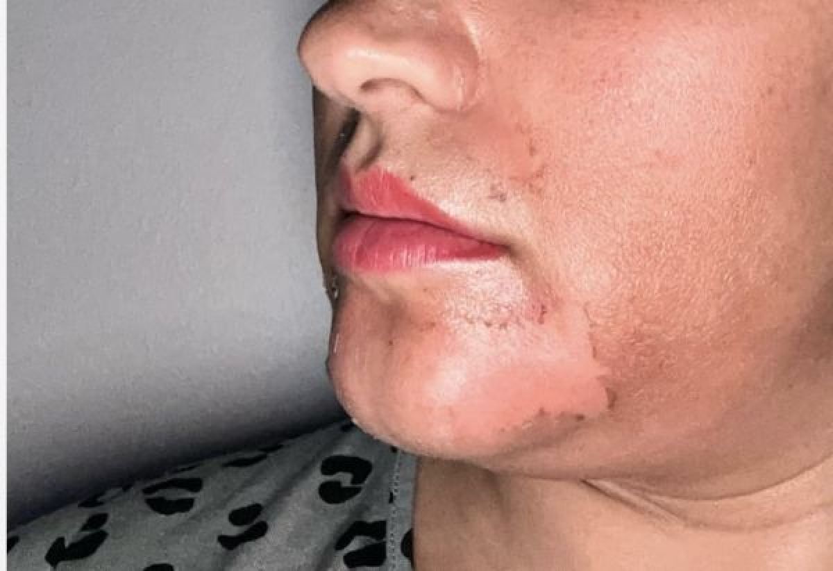 Peeling aux algues à Gagny (93) Par Basma - Estheca