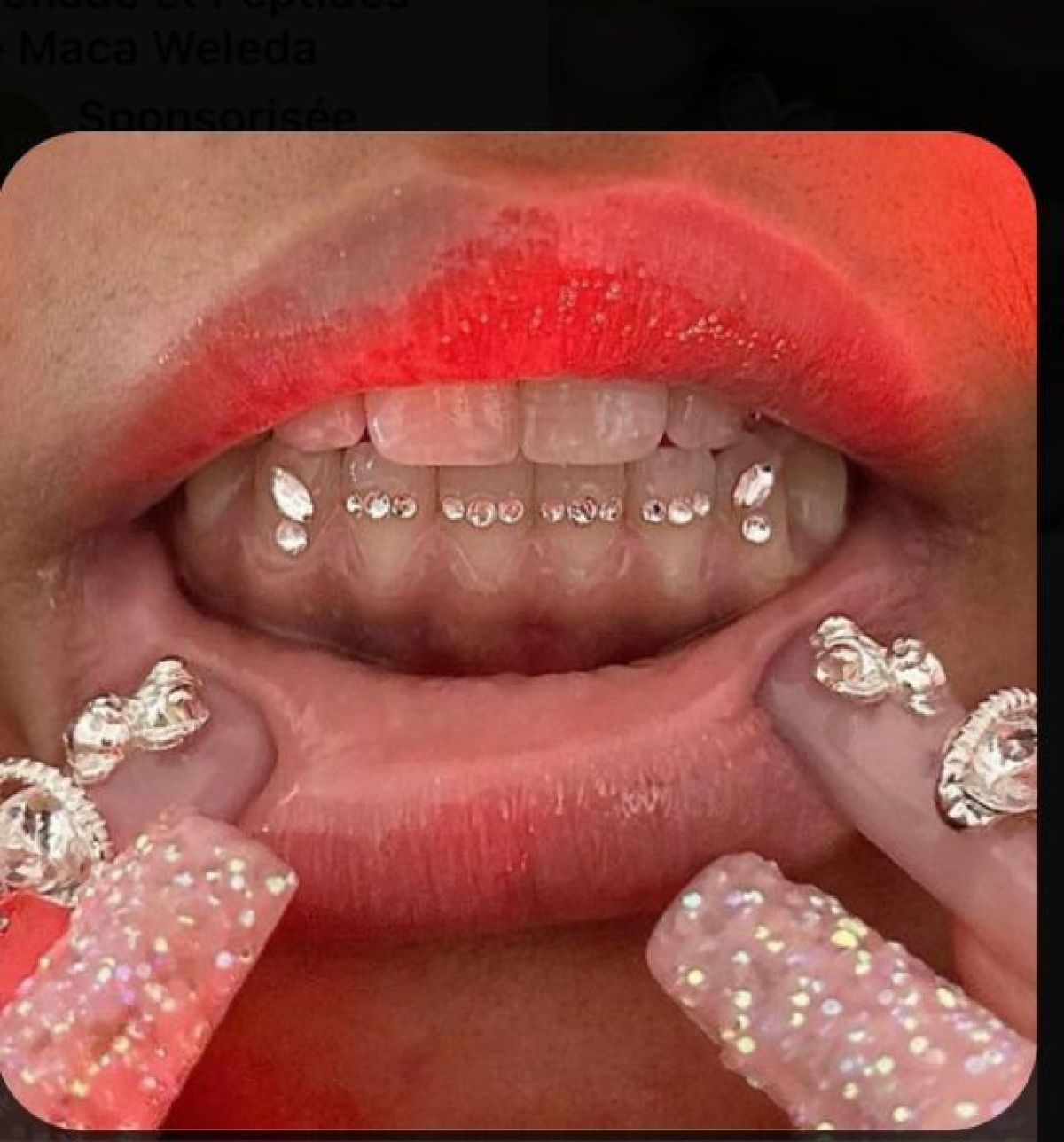 Strass Dentaires à Rennes (35) Par Sabrina - Estheca