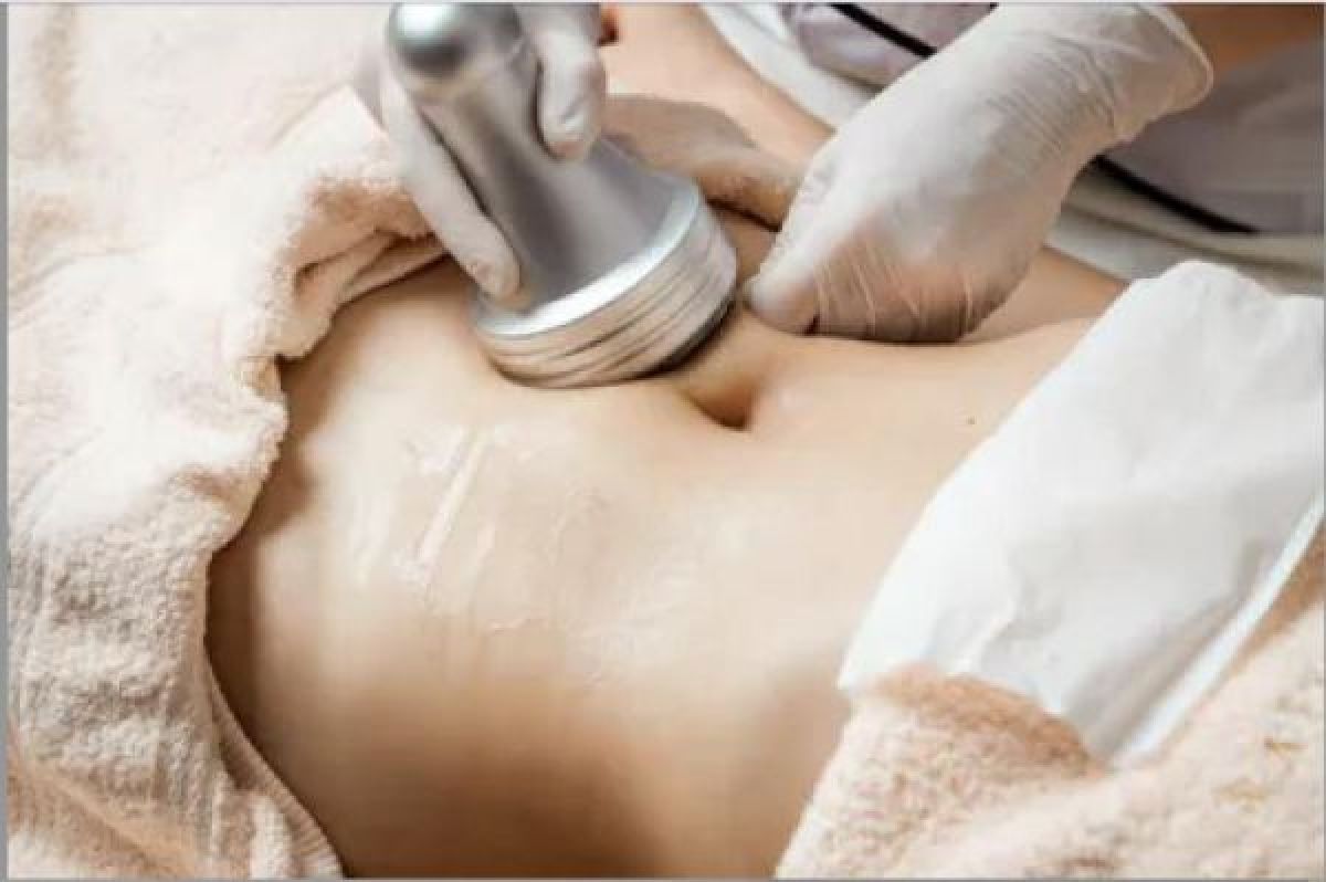 Lipocavitation / radiofréquence à Guignes (77) Par Andreia - Estheca