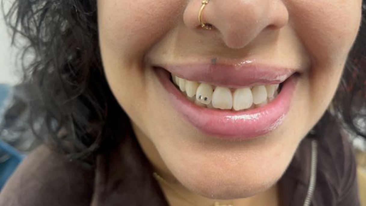 Blanchiment dentaire  à Noisy-le-Grand (93) Par Kenza - Estheca