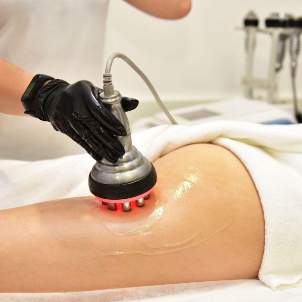 À Villiers-sur-Marne | Lipocavitation / radiofrequence | Les meilleures esthéticiennes