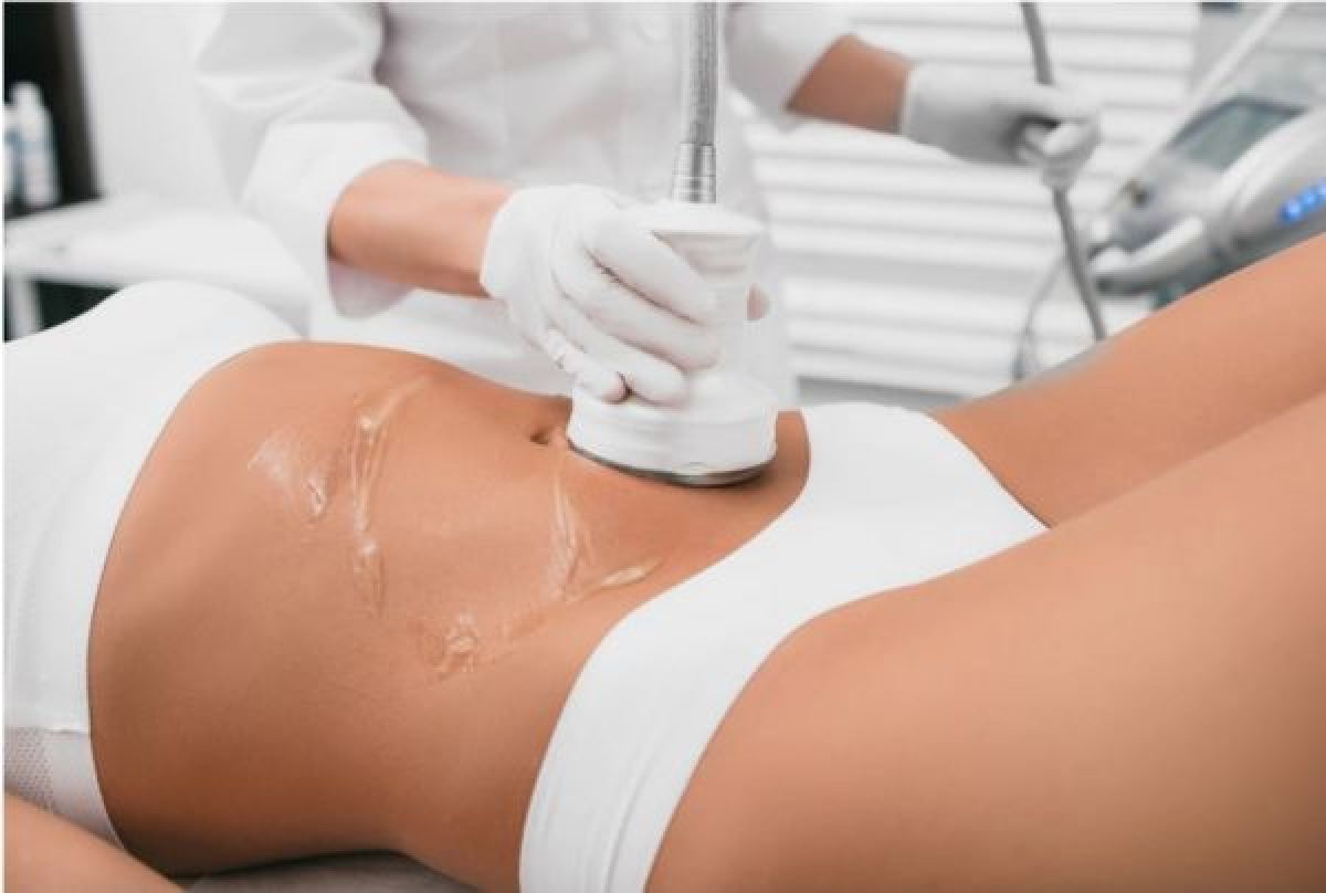 Ecole privée Esthétique et Coiffure Ambassaderm - Formation Lipocavitation  avec Radiofréquence - 1 jour / 600 € 🔎La lipocavitation agit sur les amas  graisseux localisés. Elle utilise les ondes ultrasoniques pour détruire