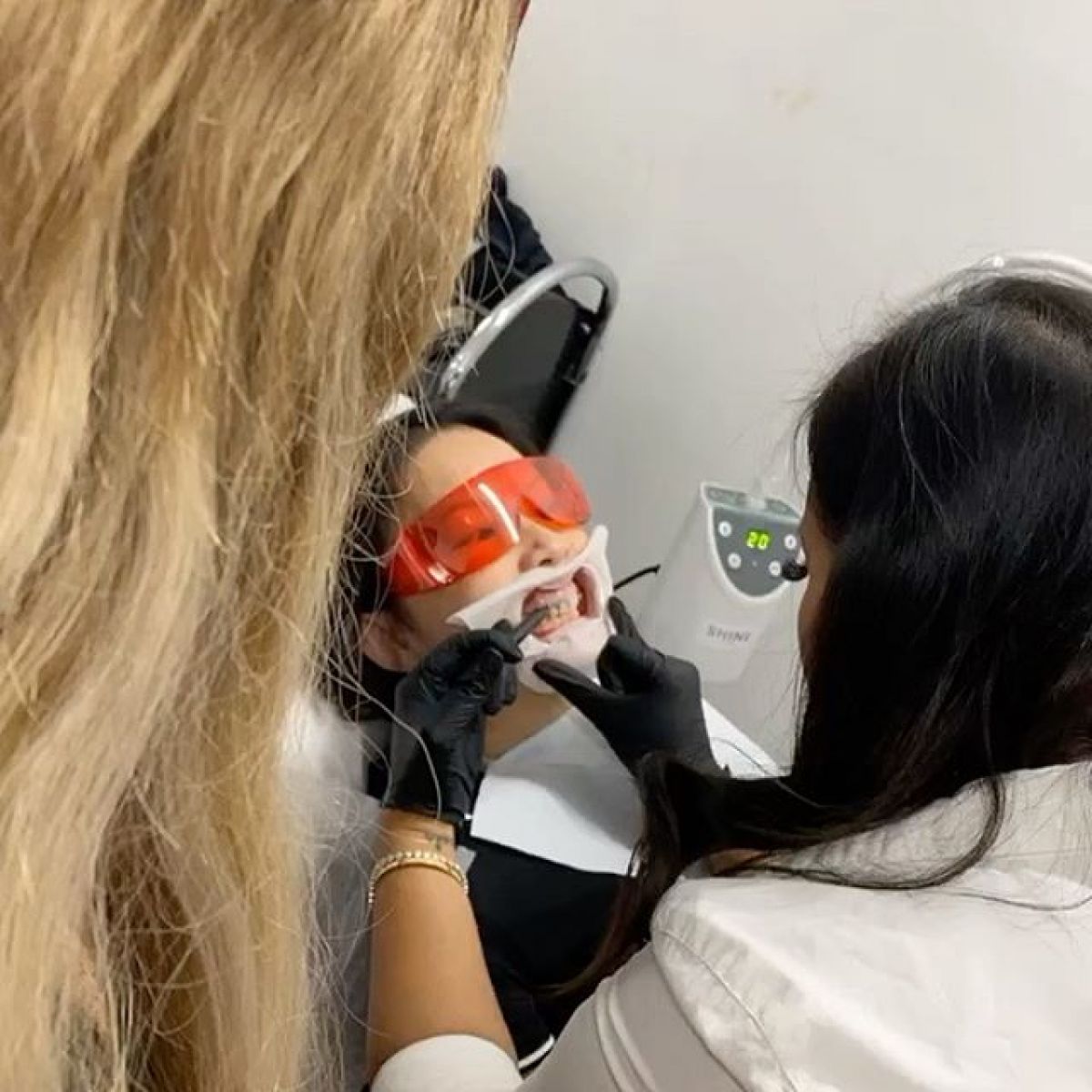 Blanchiment dentaire à Villeneuve-Loubet (06) Par Amandine - Estheca