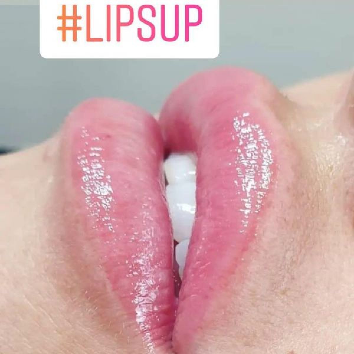 Lips Up à Rozay-en-Brie (77) Par Catia - Estheca