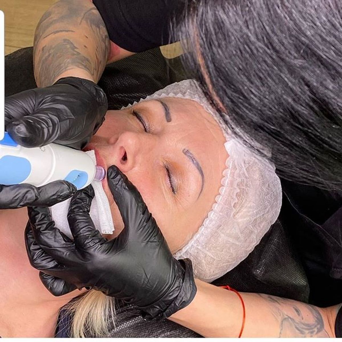 Augmentation lèvres Hyaluron pen à Saint-Médard-en-Jalles (33) Par Mélody - Estheca