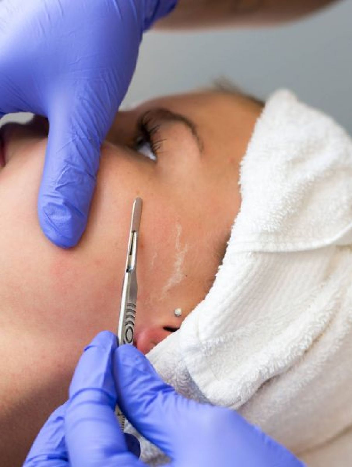 Dermaplanning à Corbeil-Essonnes (91) Par Prescillia - Estheca
