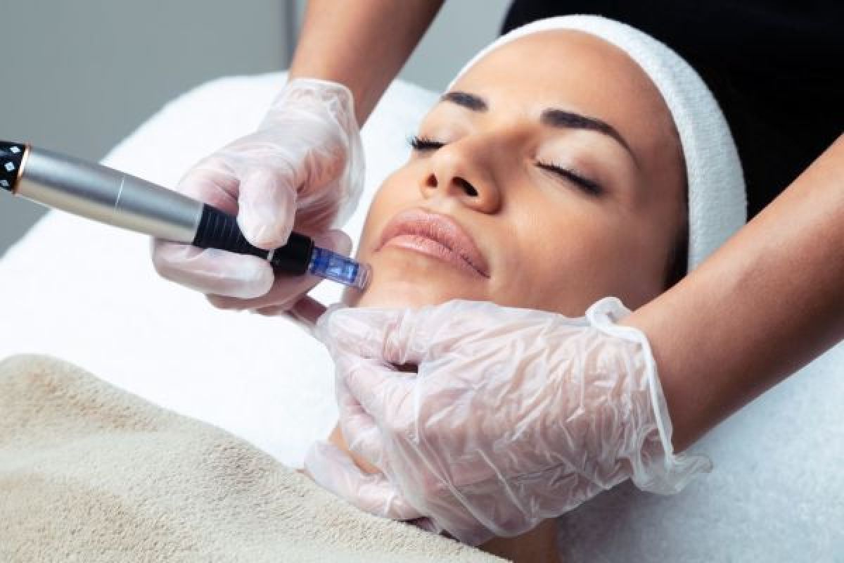 Microneedling(traces d'acnés, imperfections...) à Nanterre (92) Par Farah - Estheca