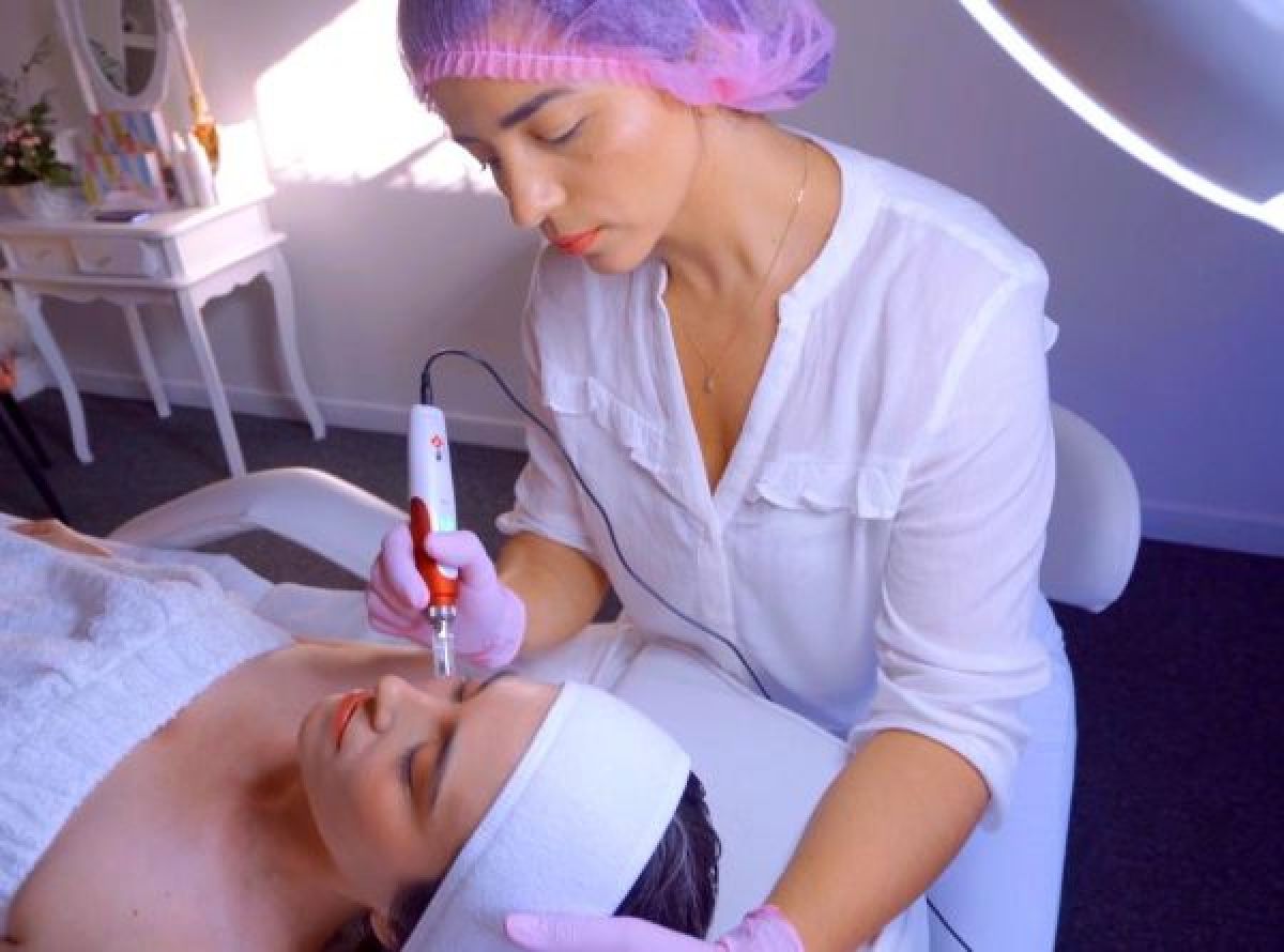 Microneedling / anti Marque / anti Rides / traite les pores à Paris (75) Par Fonseca - Estheca