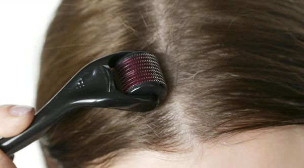 À Paris | Soin Hair Needling  | Les meilleures esthéticiennes