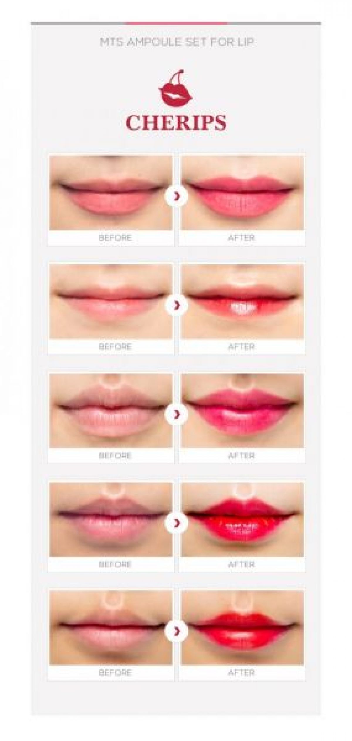 Cherips Lips  à Sens (89) Par Aurélie - Estheca