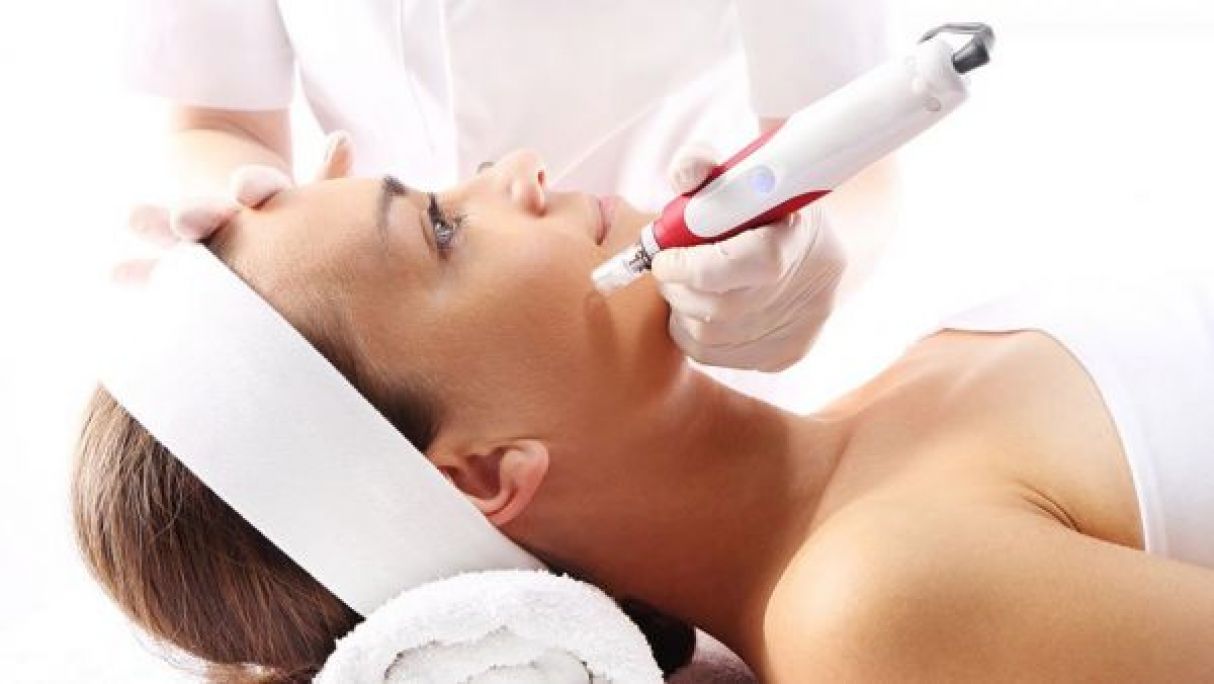 Microneedling / BB GLOW à Nantes (44) Par Johanna - Estheca