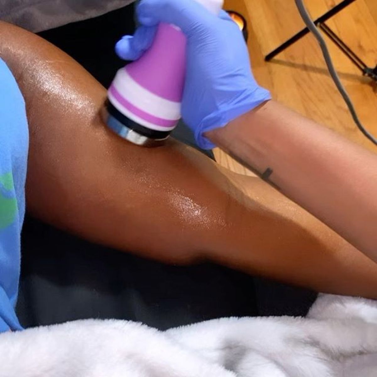 Radio fréquence et Lipocavitation à Champigny-sur-Marne (94) Par Mélody - Estheca