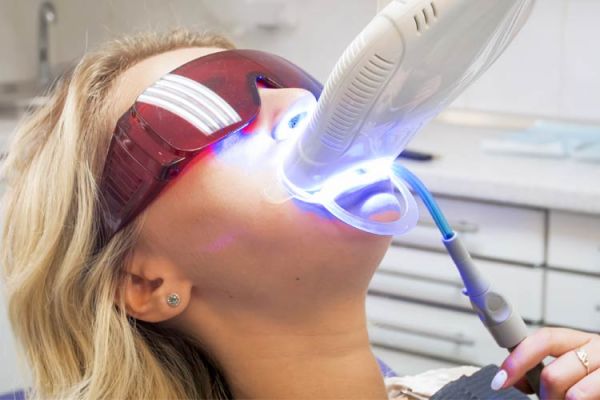 À Lens | Blanchiment dentaire professionnel  | Les meilleures esthéticiennes