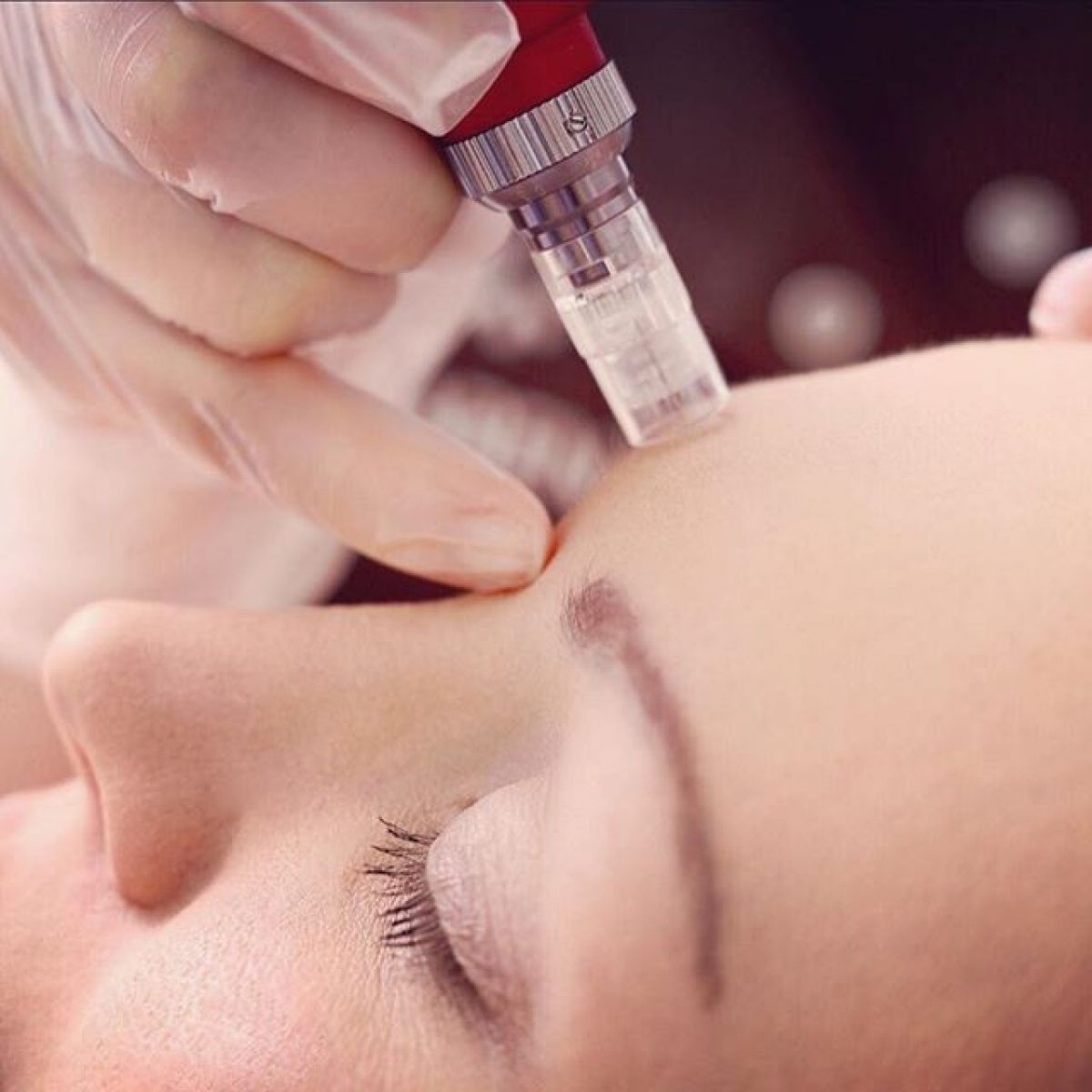 MicroNeedling BB Glow à Blagnac (31) Par Océane - Estheca