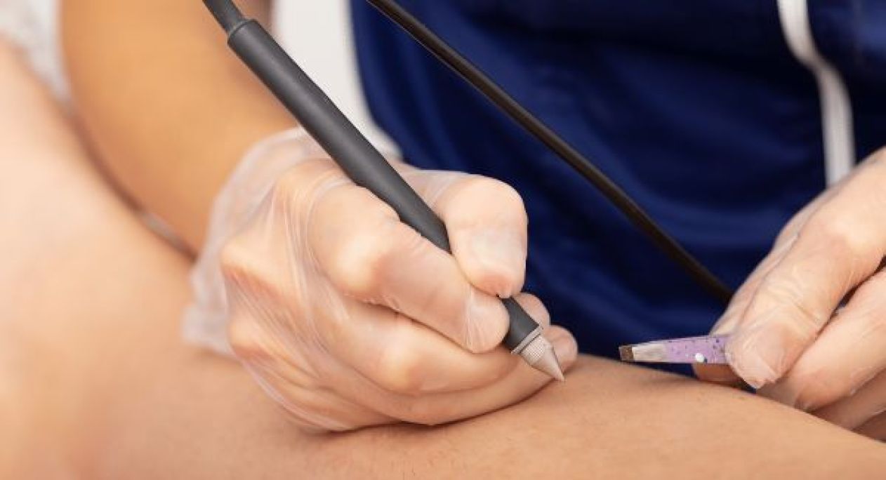 Epilation définitive electrolyse à Antibes (06) Par Fatiha - Estheca