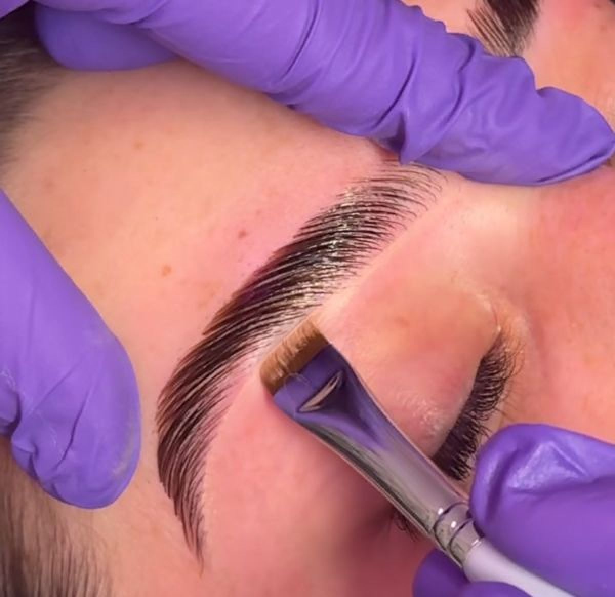 Browlift (rehaussement de sourcils) à Montpellier (34) Par Manare - Estheca