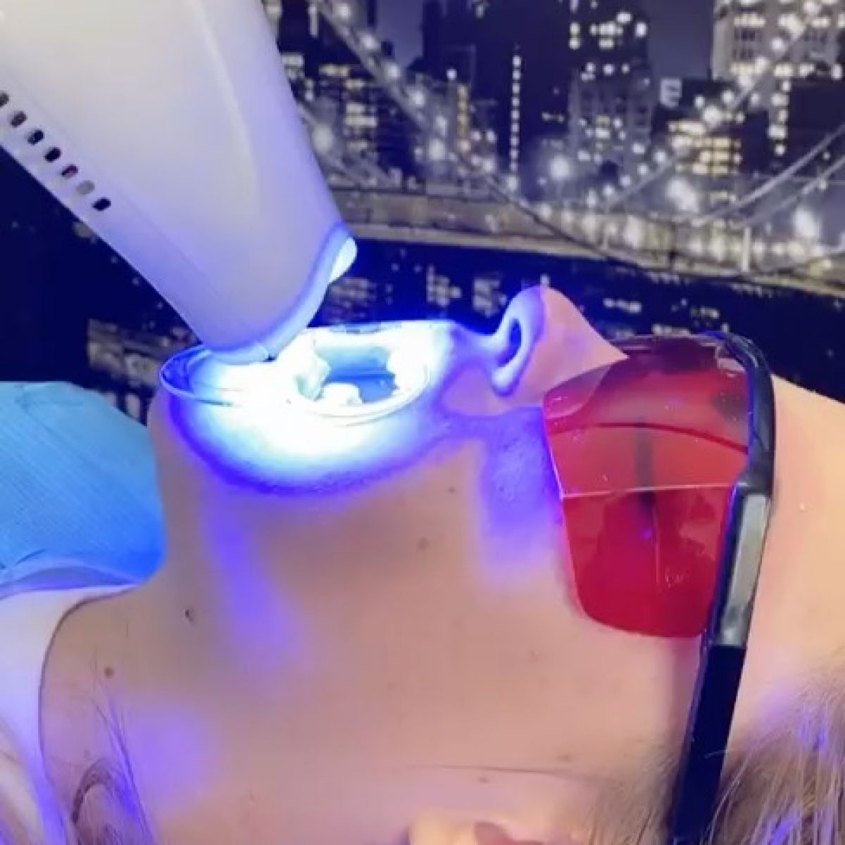Blanchiment dentaire à Tremblay-en-France (93) Par Mélodie - Estheca