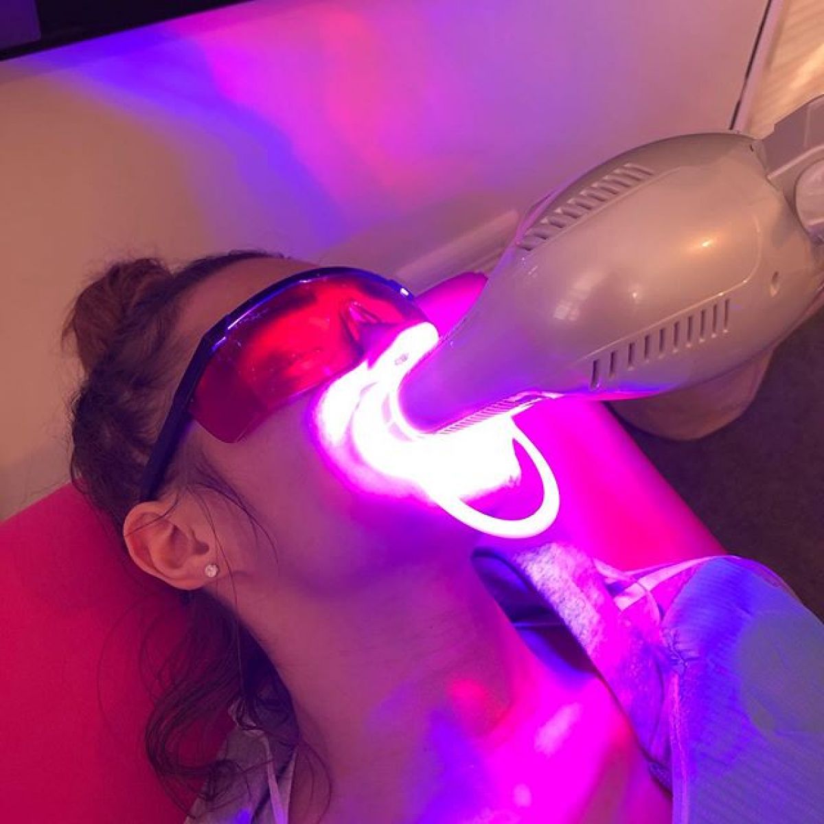 Blanchiment dentaire Pro à Vitry-sur-Seine (94) Par Angélique - Estheca