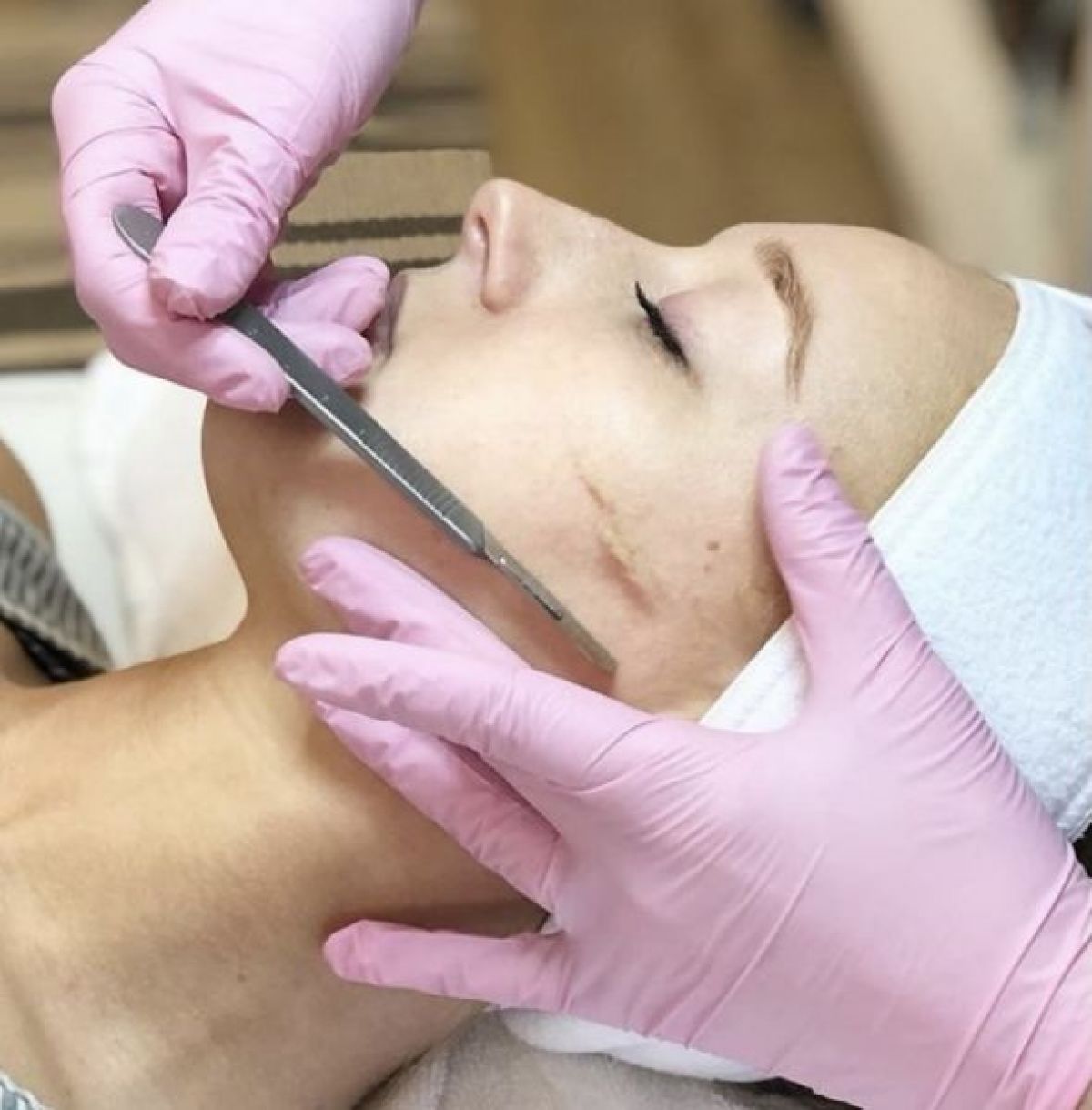 Dermaplaning à Besançon (25) Par Nermina - Estheca