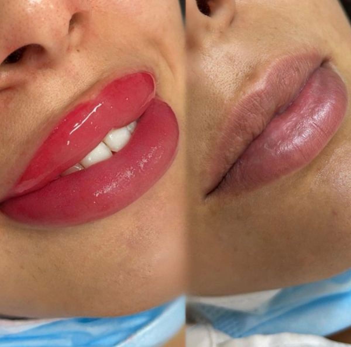 Maquillage permanent (candy lips) à Fréjus (83) Par Léa - Estheca