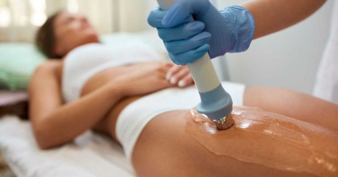 Radiofréquence et Lipocavitation à Nice (06) Par Joy - Estheca