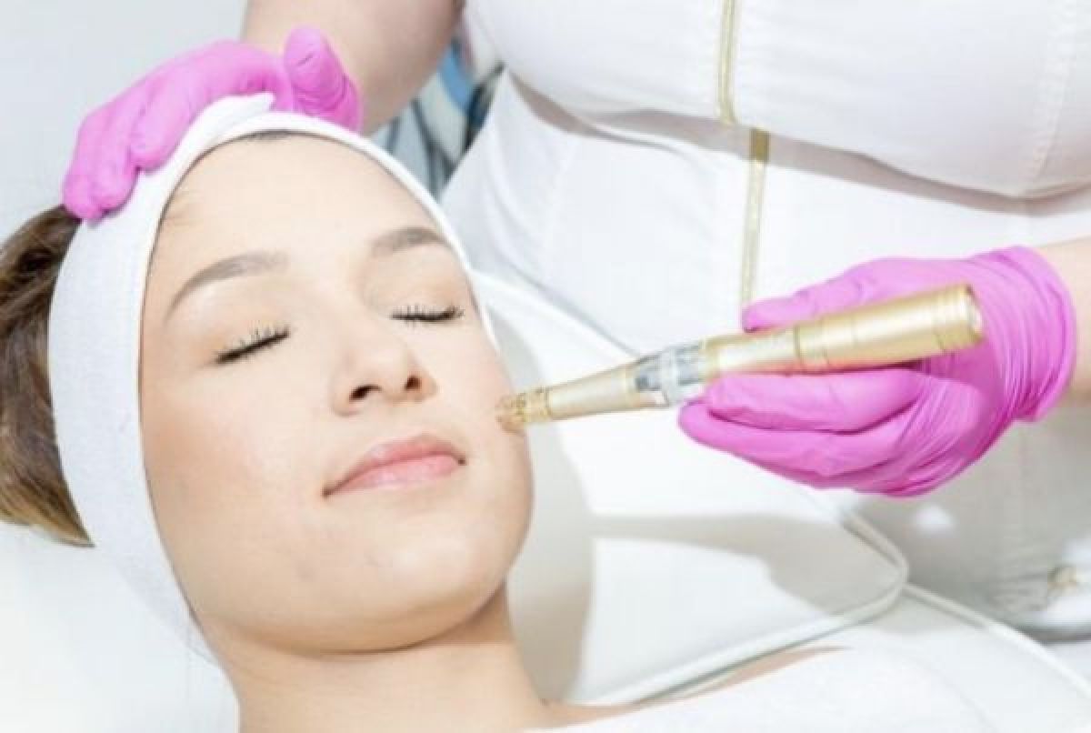 MicroNeedling BB Glow à Metz (57) Par Linda - Estheca