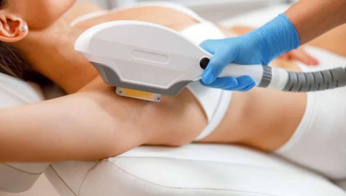 Épilation par lumière pulsée à Osny (95) Par Sabrina - Estheca