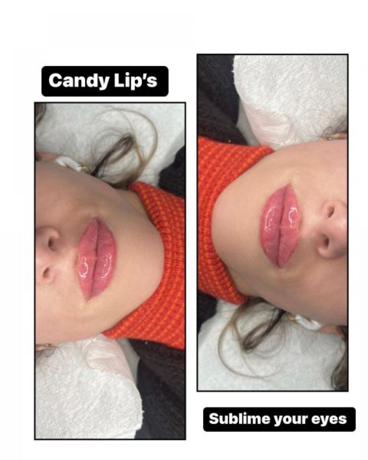 Maquillage permanent lèvres (candy lips) à Boussy-Saint-Antoine (91) Par Fatima - Estheca