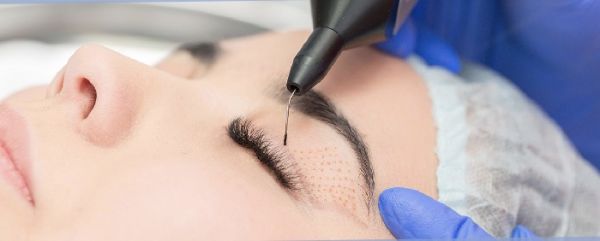 À Paris | Plasma Lift | Les meilleures esthéticiennes