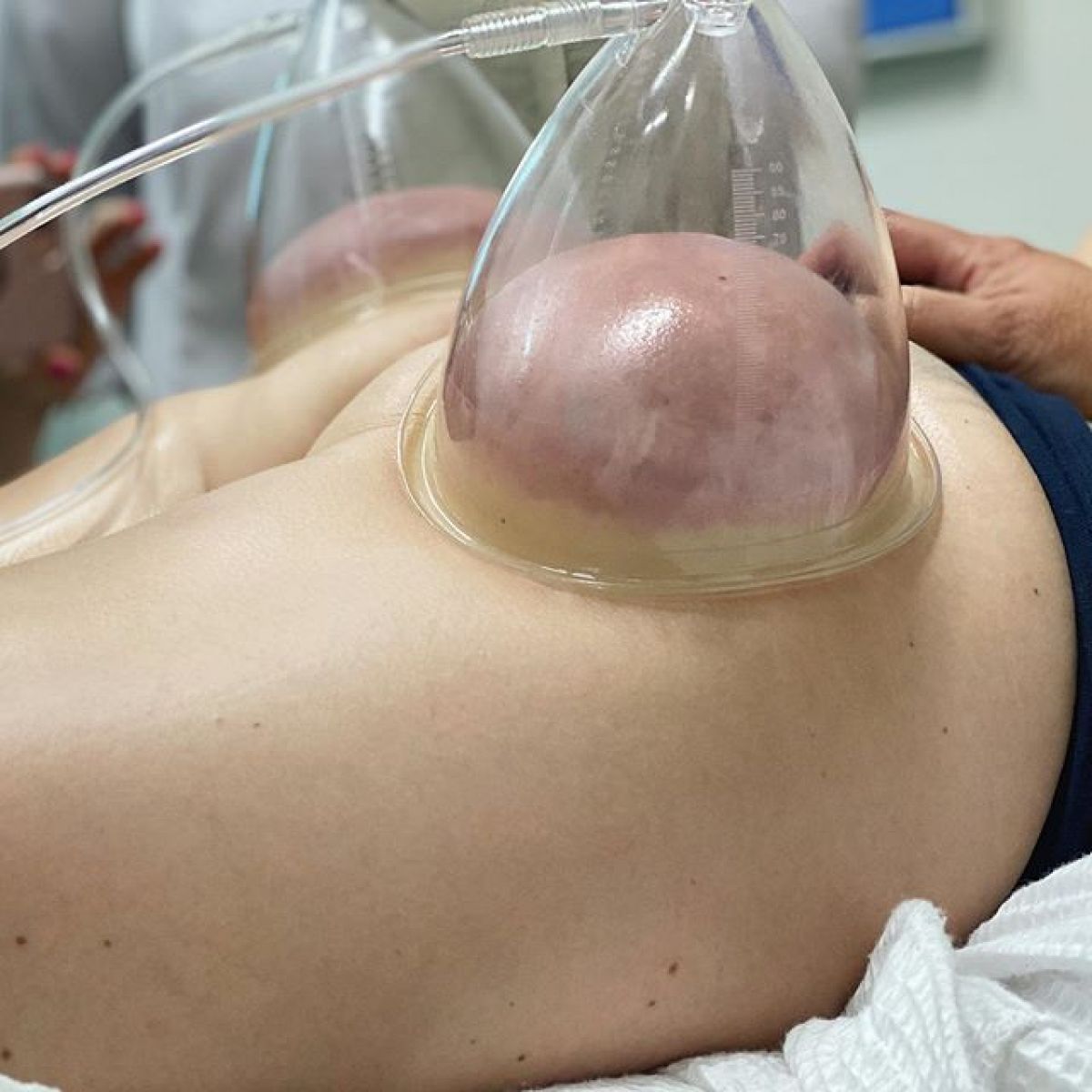 Lifting Colombien à Castanet-Tolosan (31) Par Gwendoline - Estheca