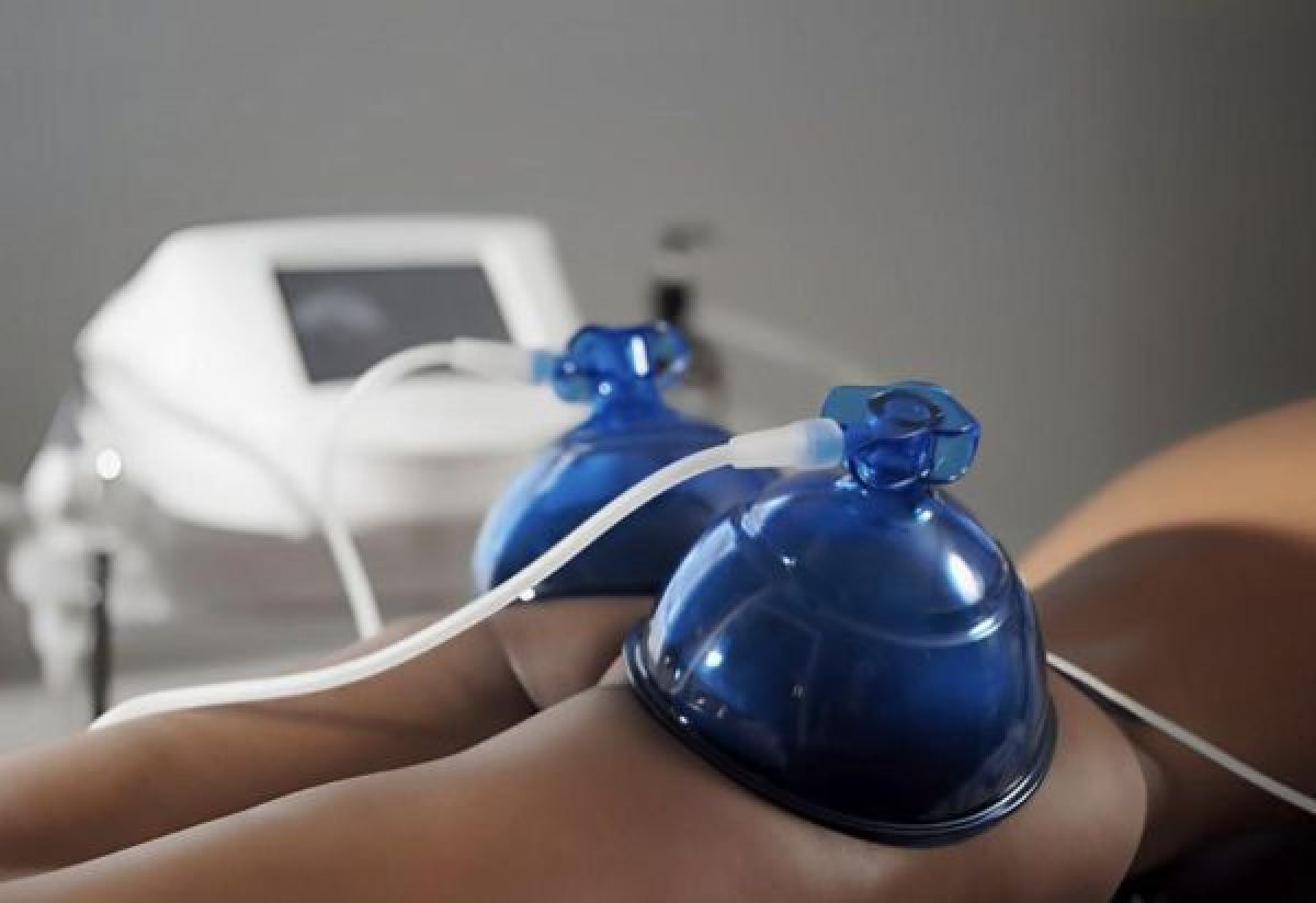 Lifting Colombien à Paris (75) Par Bouchra - Estheca