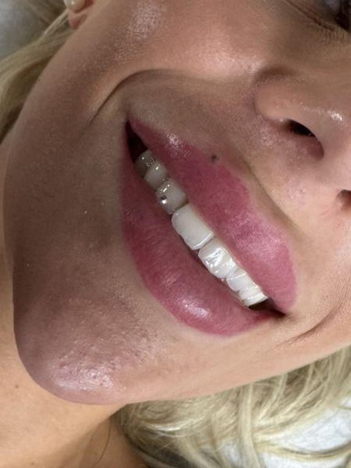 Strass dentaire à Noisy-le-Grand (93) Par Kenza - Estheca