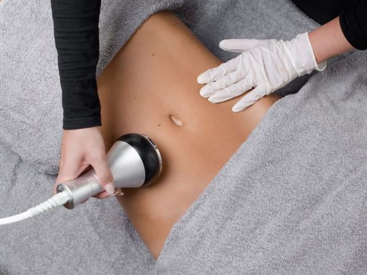 Lipocavitation à Vernon (27) Par Jennifer - Estheca