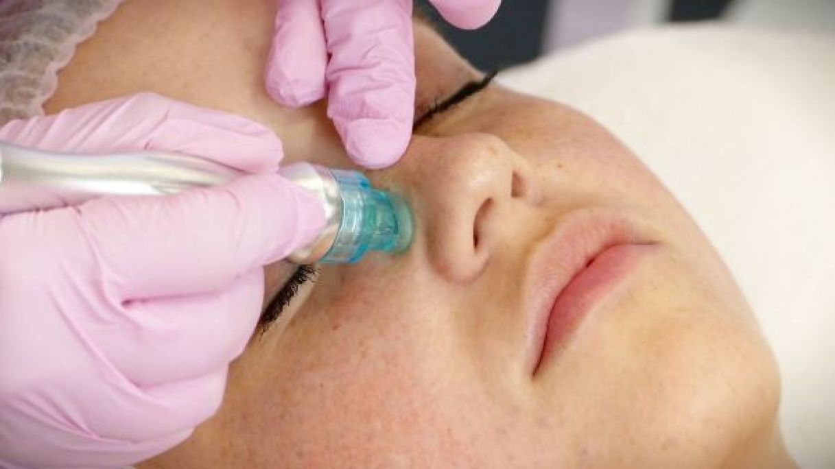 Hydrated Face (nettoyage de peau en profondeur) à Duppigheim (67) Par Rosa - Estheca