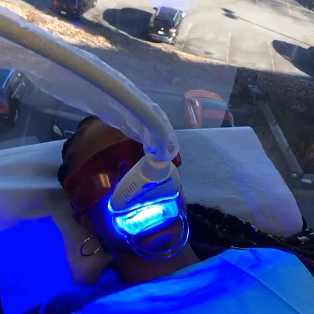 Blanchiment dentaire à Massy (91) Par Chloé - Estheca