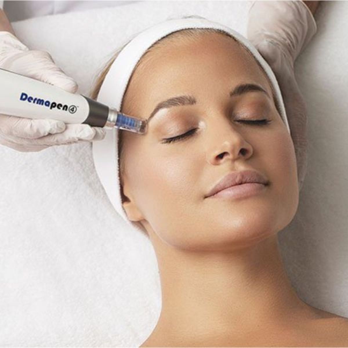 MicroNeedling BB Glow à Plescop (56) Par Margaux - Estheca