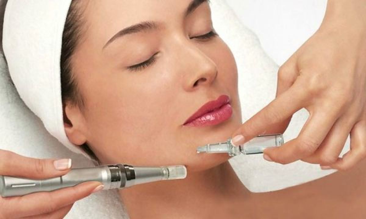 MicroNeedling BB Glow à Ensuès-la-Redonne (13) Par Angelique - Estheca
