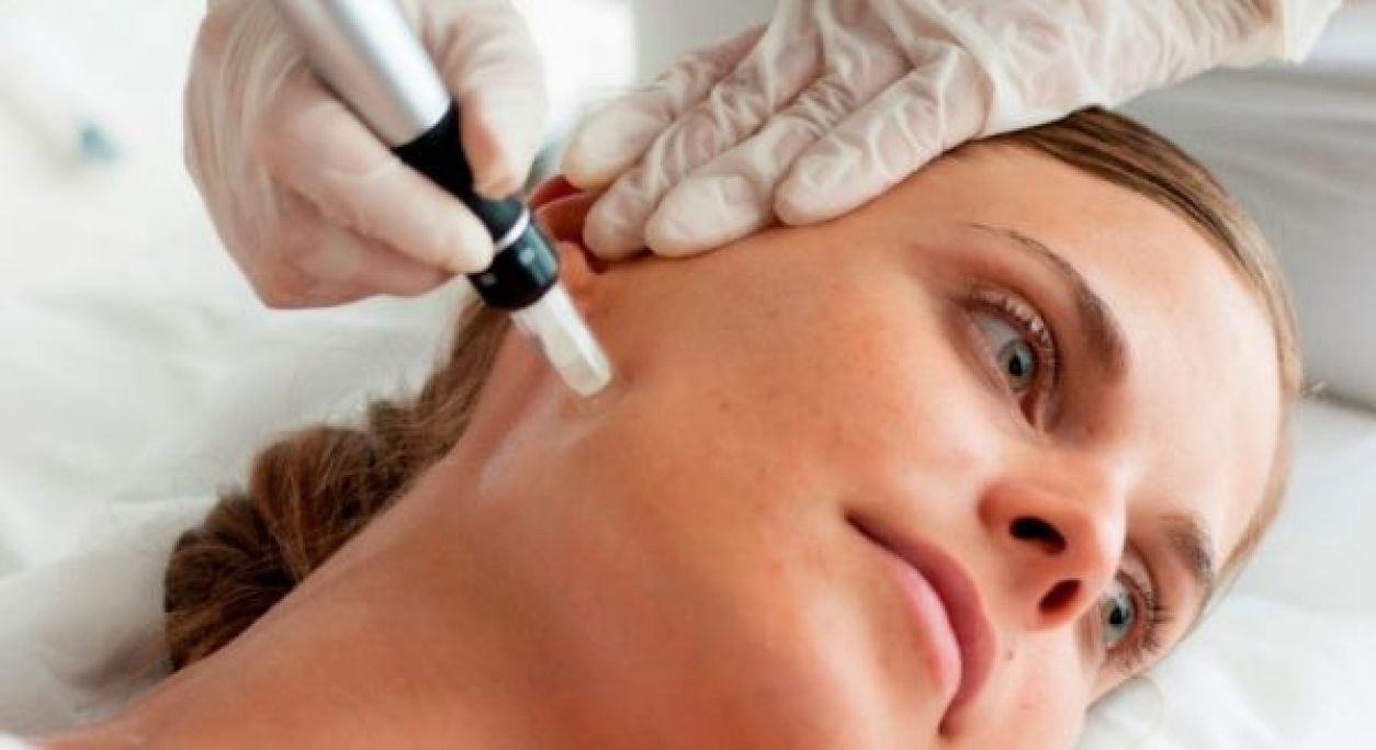 Microneedling BB GLOW à Toulon (83) Par Sarah - Estheca