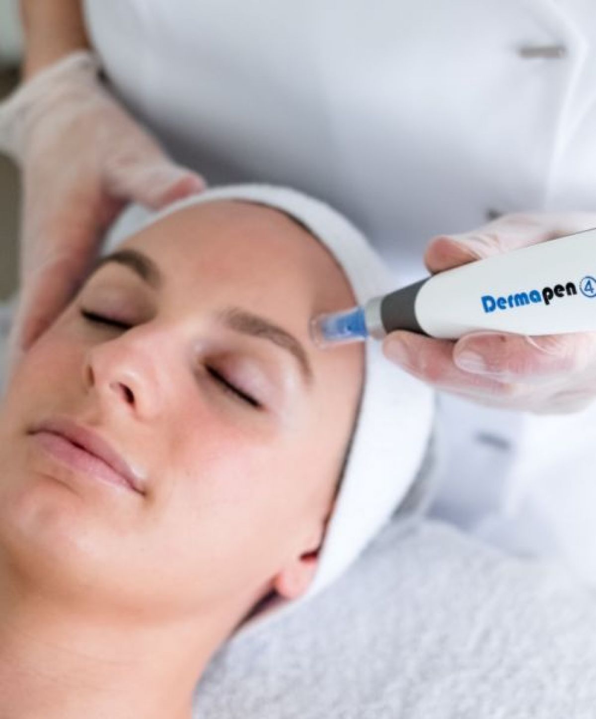 MicroNeedling BB Glow à Chamalières (63) Par Cindy - Estheca