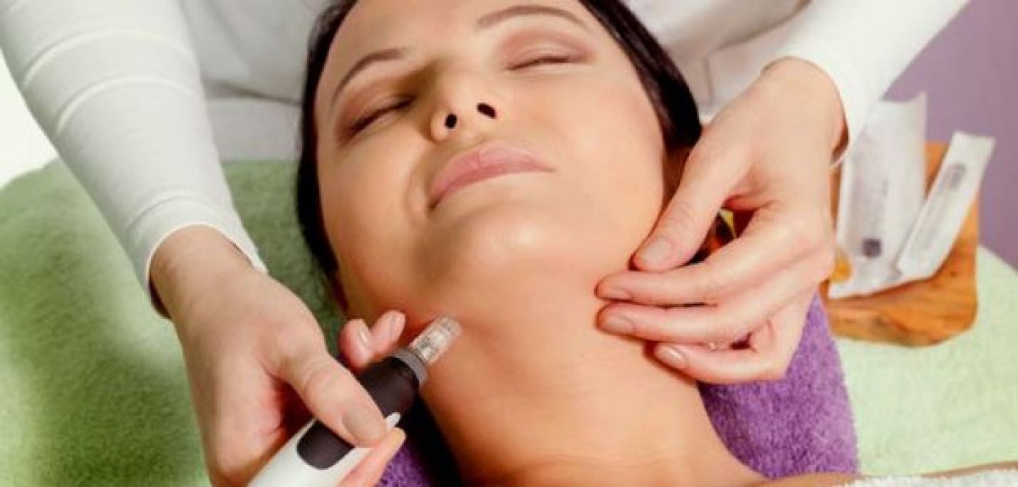MicroNeedling BB Glow à Laval (53) Par Christelle - Estheca