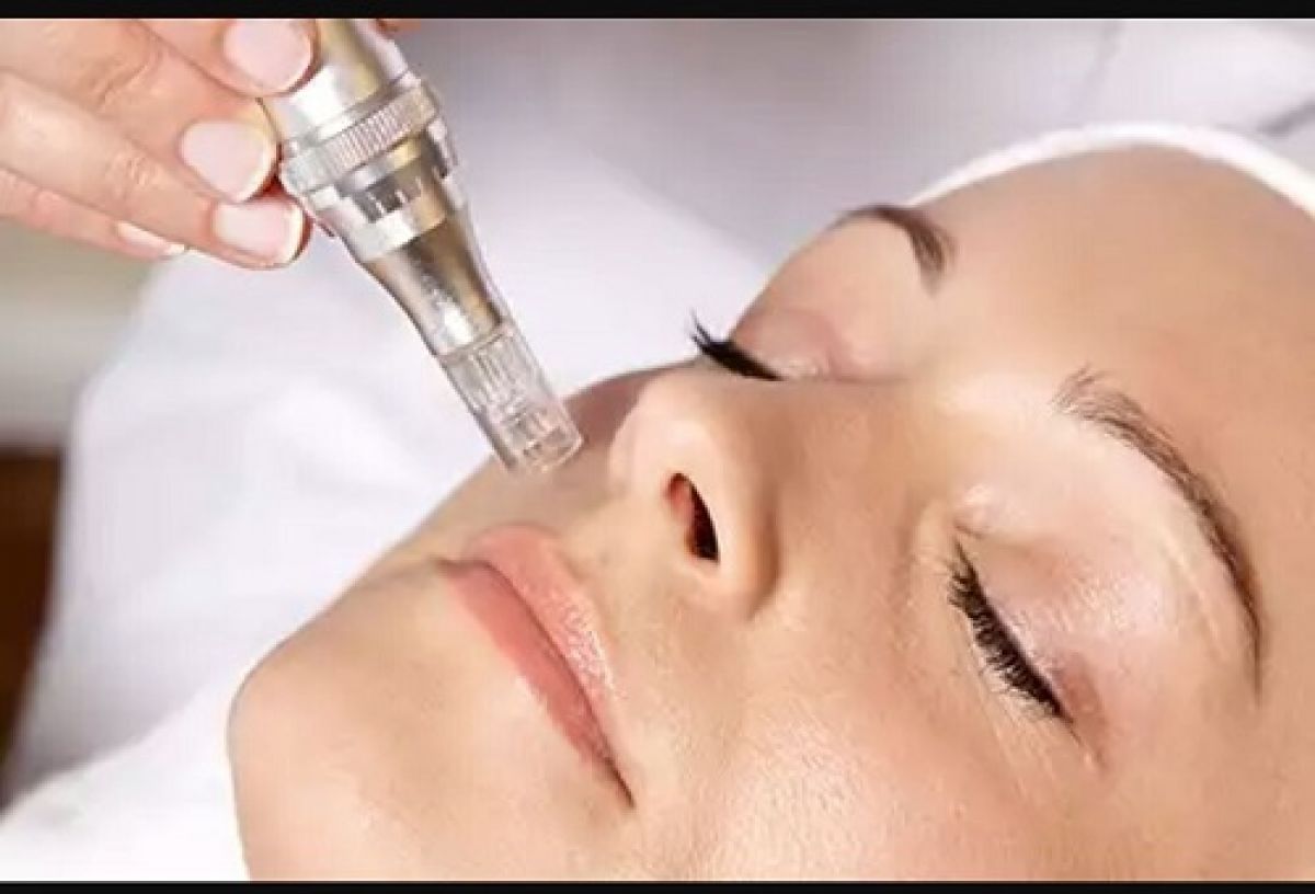 MicroNeedling BB Glow à Châteauroux (36) Par Christelle - Estheca