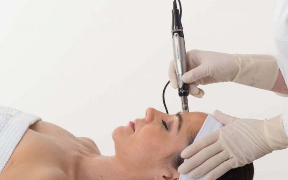 MicroNeedling BB Glow à Champcevinel (24) Par Malika - Estheca