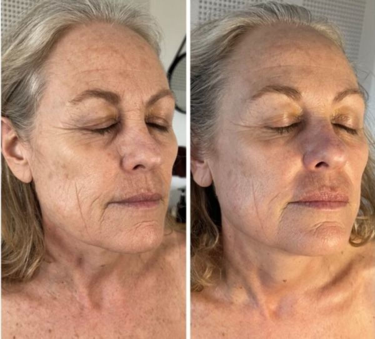 Massage facial KOBIDO à Pia (66) Par Solène - Estheca